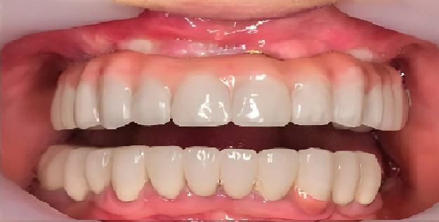 After Image