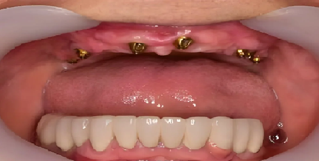 Before Image